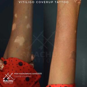 Scar Coverup Tattoo