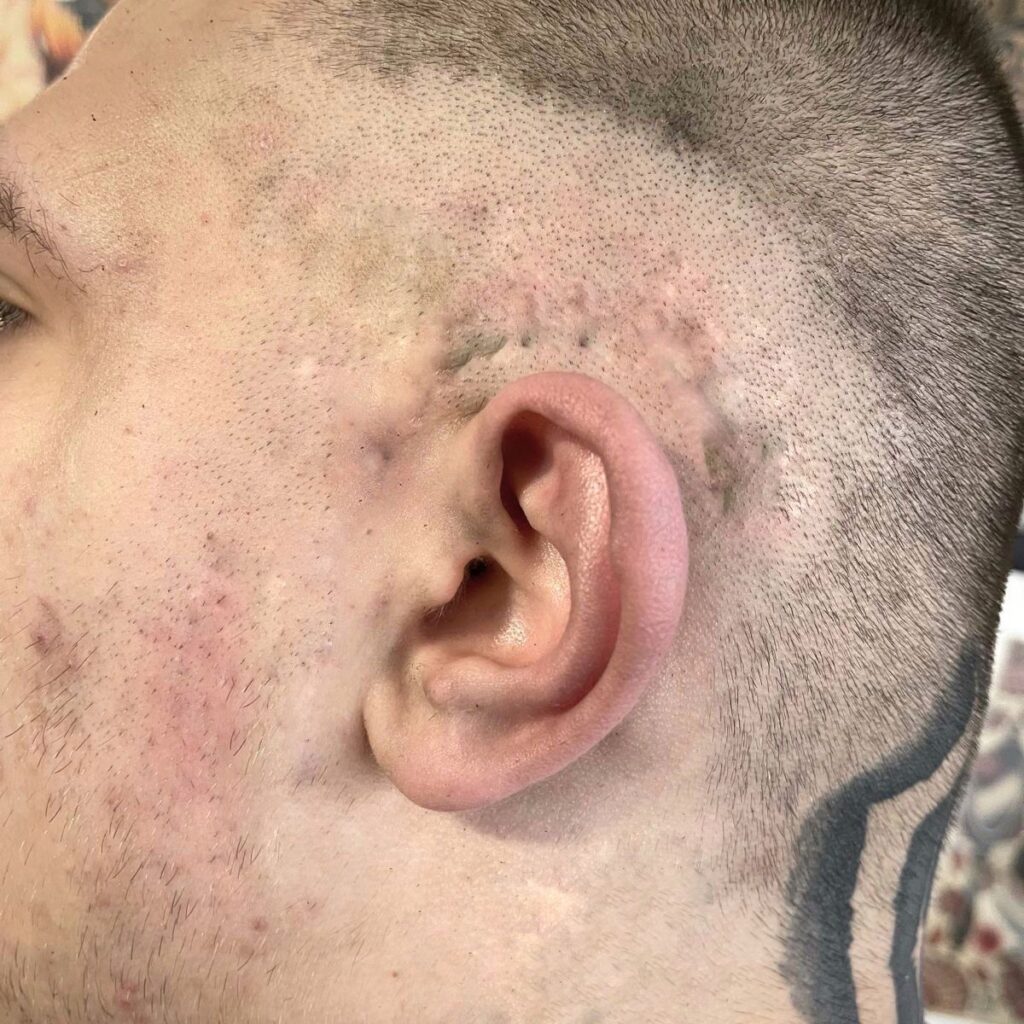 Most Painful vs Least Painful Tattoo Spots